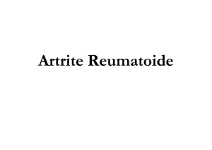Artrite Reumatoide Reumatoide