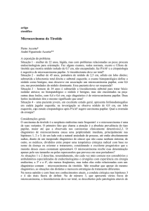 Microcarcinoma da Tireóide - Associação Médica Fluminense