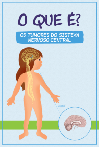Tumores do Sistema Nervoso Central