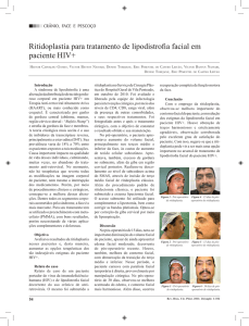 Ritidoplastia para tratamento de lipodistrofia facial em paciente HIV+