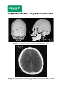 Imagem da Semana: Tomografia Computadorizada - Unimed-BH