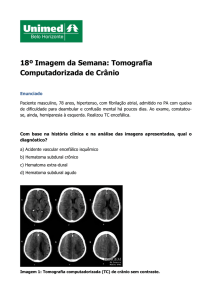 18º Imagem da Semana: Tomografia Computadorizada de Crânio