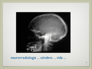 neurorradiologia cérebro vida