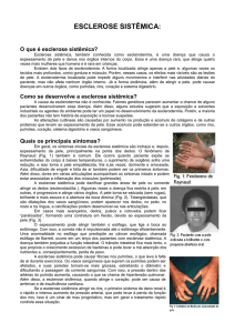 esclerose sistmica - Sociedade de Reumatologia do Rio Grande do