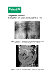 Imagem da Semana: Radiografia e tomografia - Unimed-BH