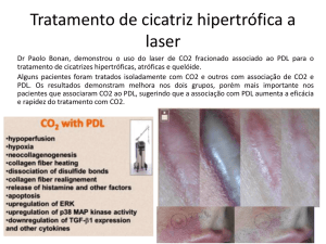 Tratamento de cicatriz hipertrófica a laser