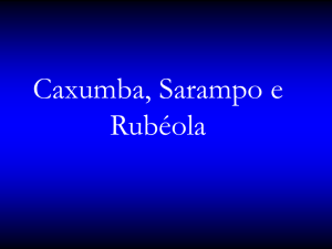 Caxumba, Sarampo e Rubéola