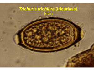 8 Trichiurus