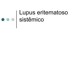 Lupus eritematoso sistêmico