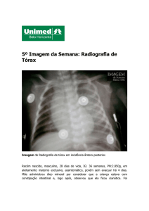 5º Imagem da Semana: Radiografia de Tórax - Unimed-BH