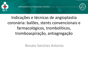 Indicações e técnicas de angioplastia coronária: balões, stents
