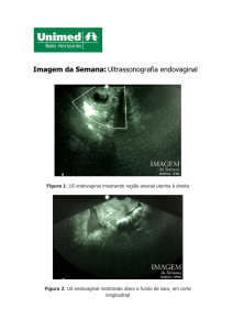 Imagem da Semana:Ultrassonografia endovaginal - Unimed-BH