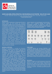 neoplasia mieloproliferativa com rearranjo no pdgfrb