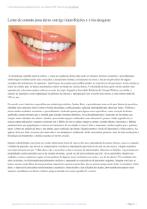 Lente de contato para dente corrige imperfeições e