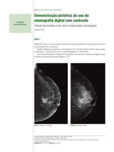 Demonstração pictórica do uso da mamografia digital com contraste