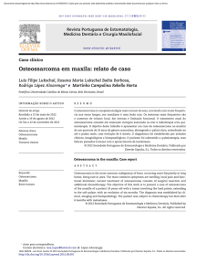 Osteossarcoma em maxila: relato de caso