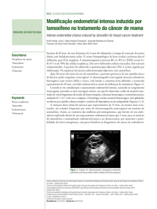 Modificação endometrial intensa induzida por tamoxifeno no