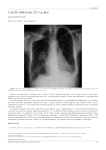 tumor fantasma do pulmão - Revista Clínica do Hospital Prof. Doutor