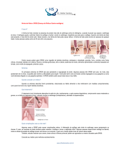 Hérnia de Hiato e DRGE (Doença do Refluxo Gastro