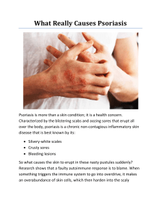 What Really Causes Psoriasis