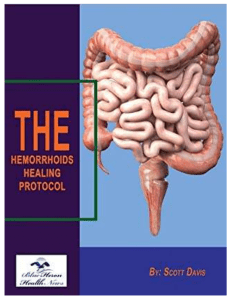 The Hemorrhoids Healing Protocol™ eBook PDF Download Free