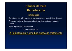 Câncer da Pele Radioterapia