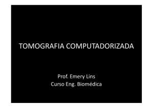 tomografia computadorizada - Engenharia Biomédica » UFABC