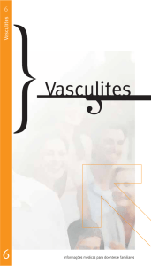 Vasculites - Sociedade Portuguesa de Medicina Interna