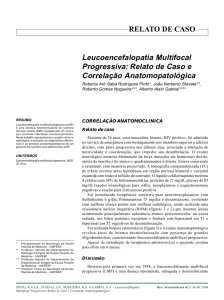 Leucoencefalopatia Multifocal Progressiva: Relato de Caso e