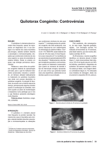 Quilotorax Congénito: Controvérsias
