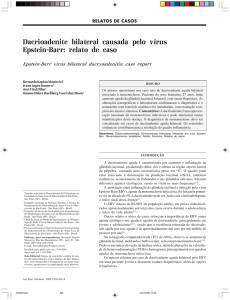 Dacrioadenite bilateral causada pelo vírus Epstein