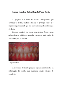 Doença Gengival Induzida pela Placa Dental