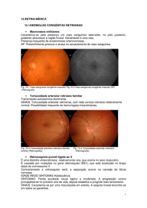 15.RETINA MÉDICA 15.1ANOMALIAS CONGÉNITAS RETINIANAS