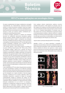 PET-CT e suas aplicações em oncologia clínica