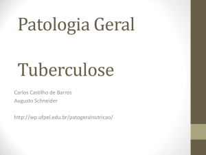 Tuberculose