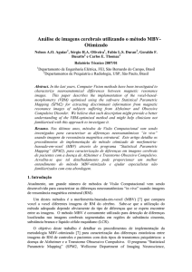 Analise de Imagens Cerebrais utilizando o Metodo MBV