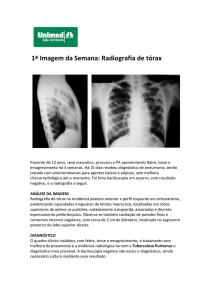 1ª Imagem da Semana: Radiografia de tórax - Unimed-BH