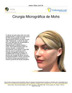 Cirurgia Micrográfica de Mohs