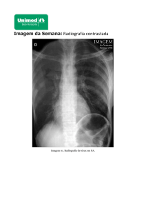 Imagem da Semana: Radiografia contrastada - Unimed-BH