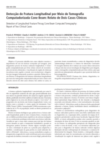 Detecção de Fratura Longitudinal por Meio de Tomografia