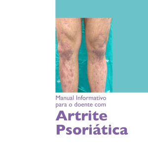 Artrite Psoriática