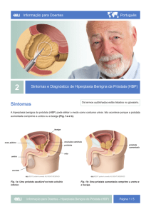 Sintomas - EAU Patient Information