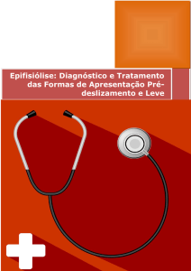 Epifisiólise: Diagnóstico e Tratamento das Formas de
