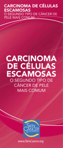 carcinoma de células escamosas