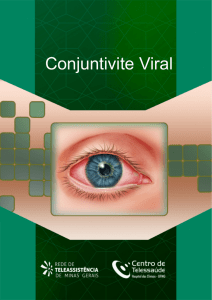 Conjuntivite Viral