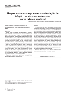 Herpes zoster como primeira manifestação de infeção por vírus