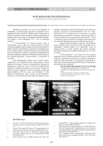 Intussuscepção intestinal - Portal de Revistas PUC SP