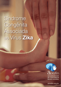 Síndrome Congênita Associada ao Vírus Zika