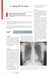Olhar e ver: O Rx pulmonar - Prof. Doutor Robalo Cordeiro