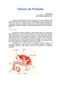 cancer de prostata o que é